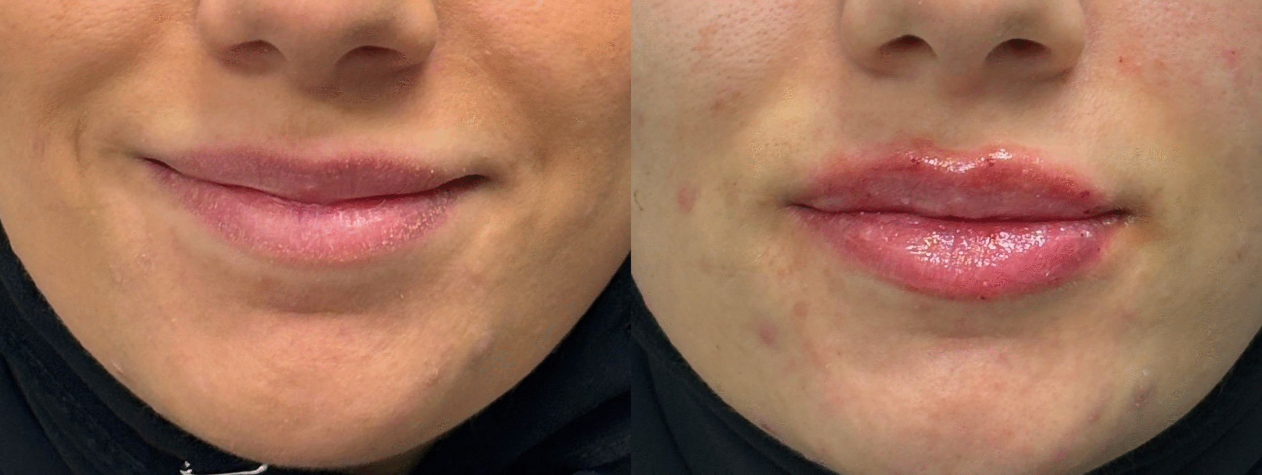 Patient #40 Marge Image