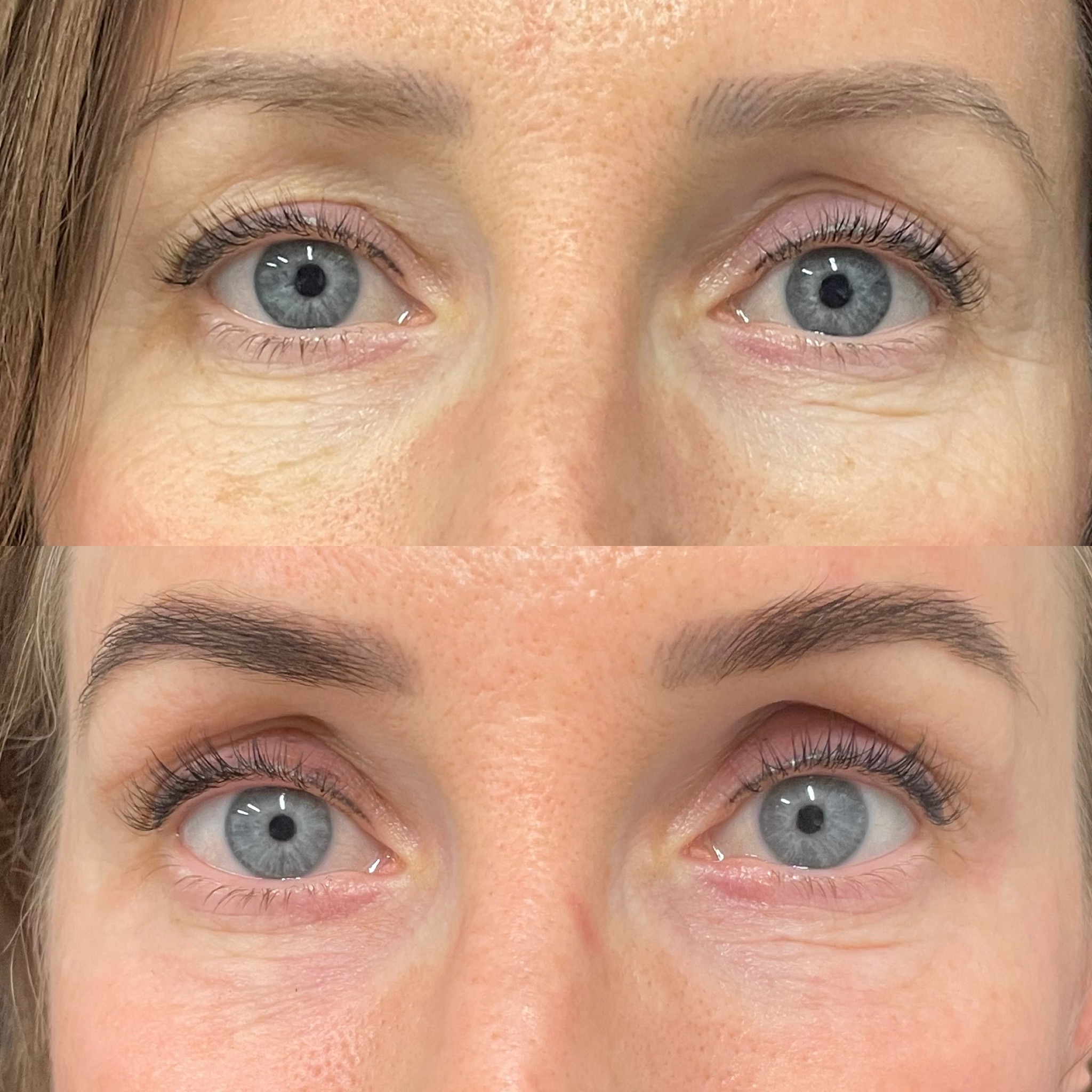 Patient #210 Marge Image