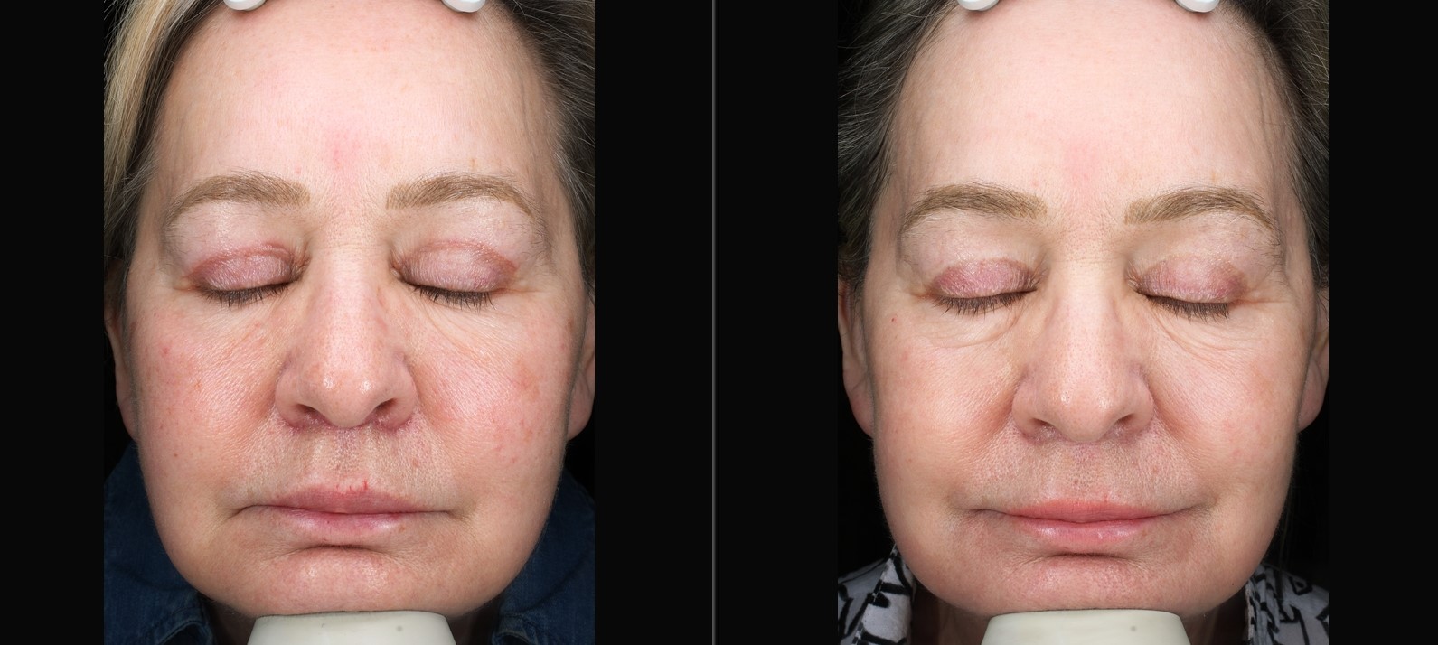 Patient #208 Marge Image