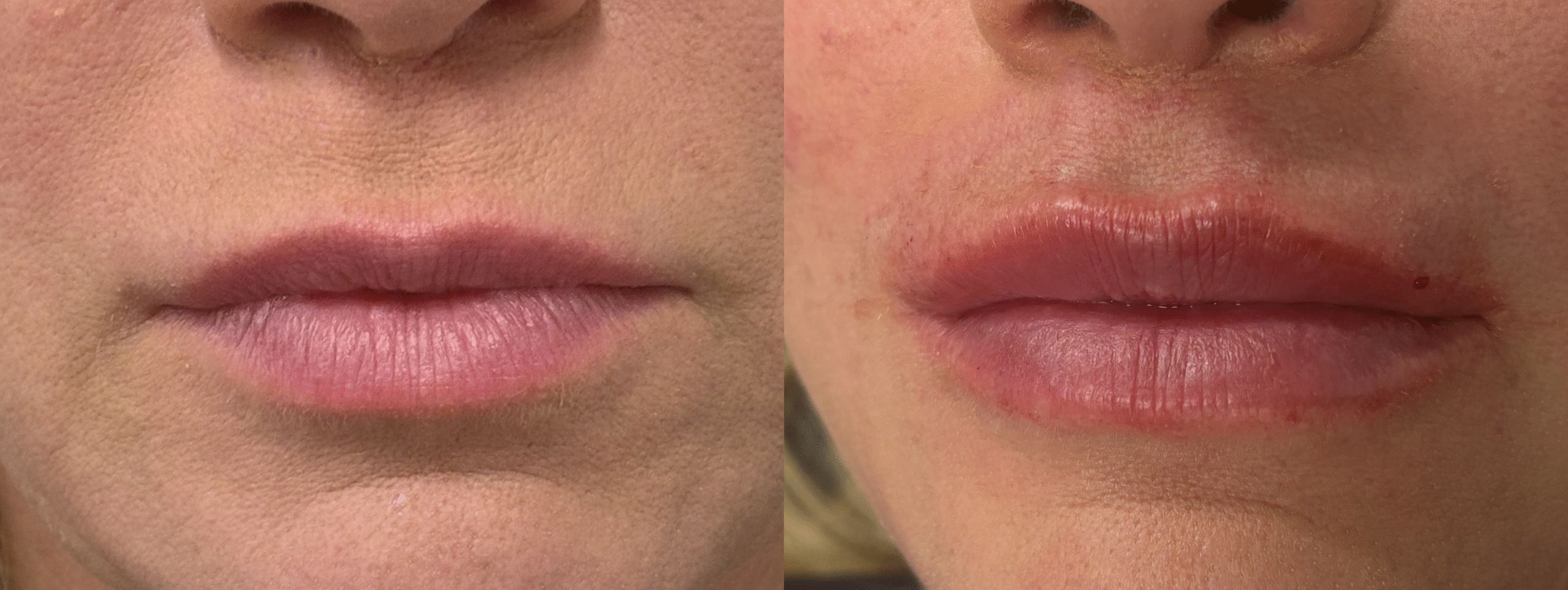 Patient #207 Marge Image