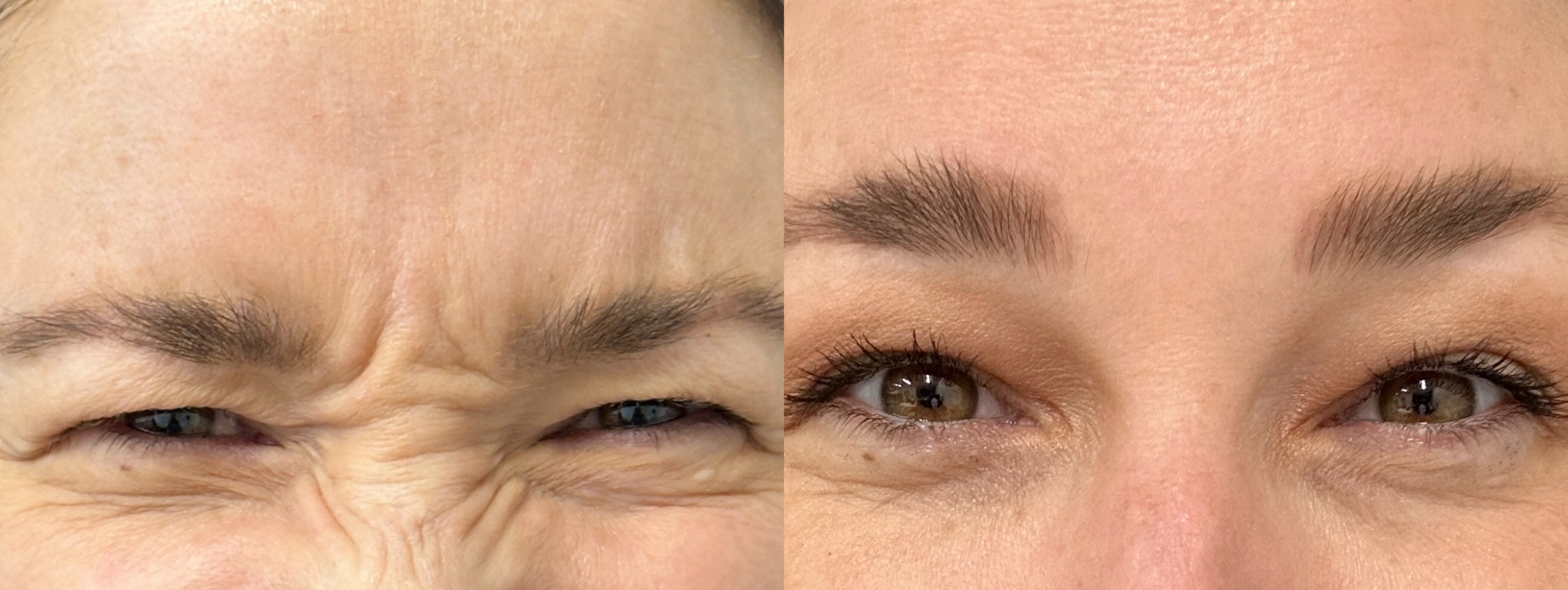 Patient #201 Marge Image