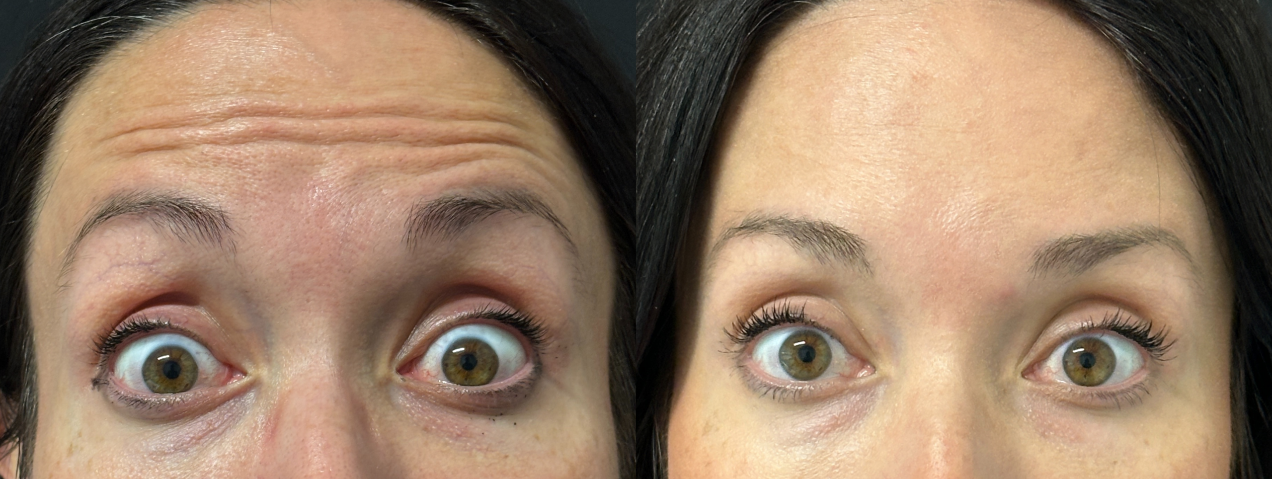 Patient #202 Marge Image