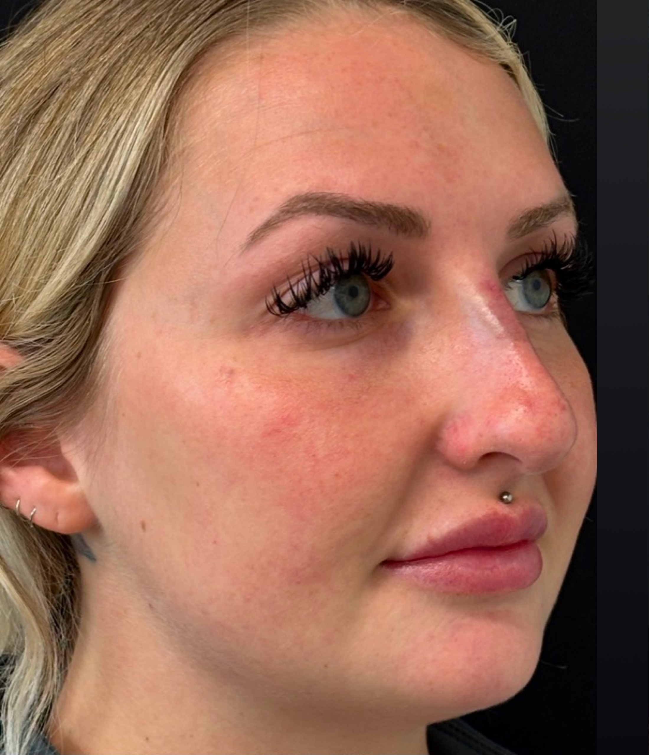 Patient #210 Before Image