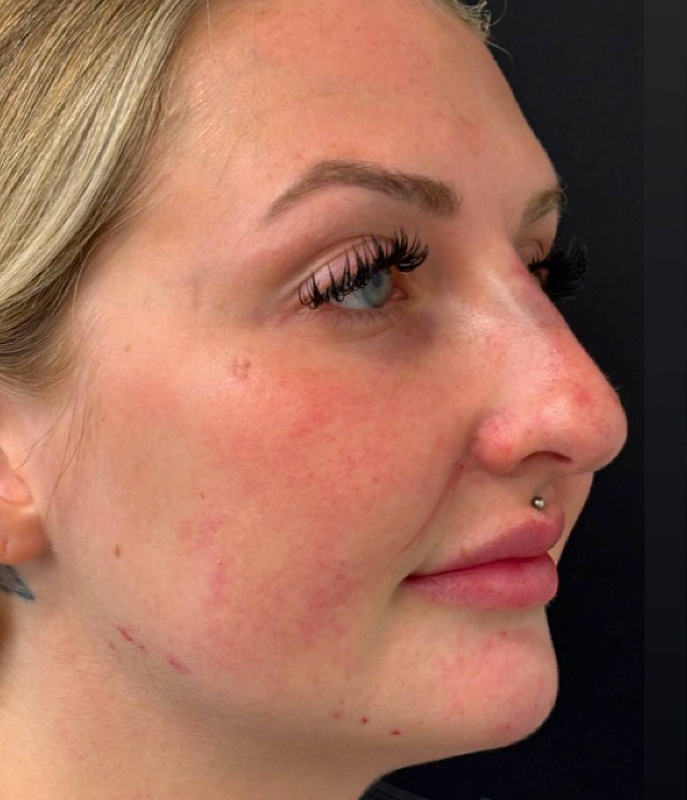 Patient #210 After Image