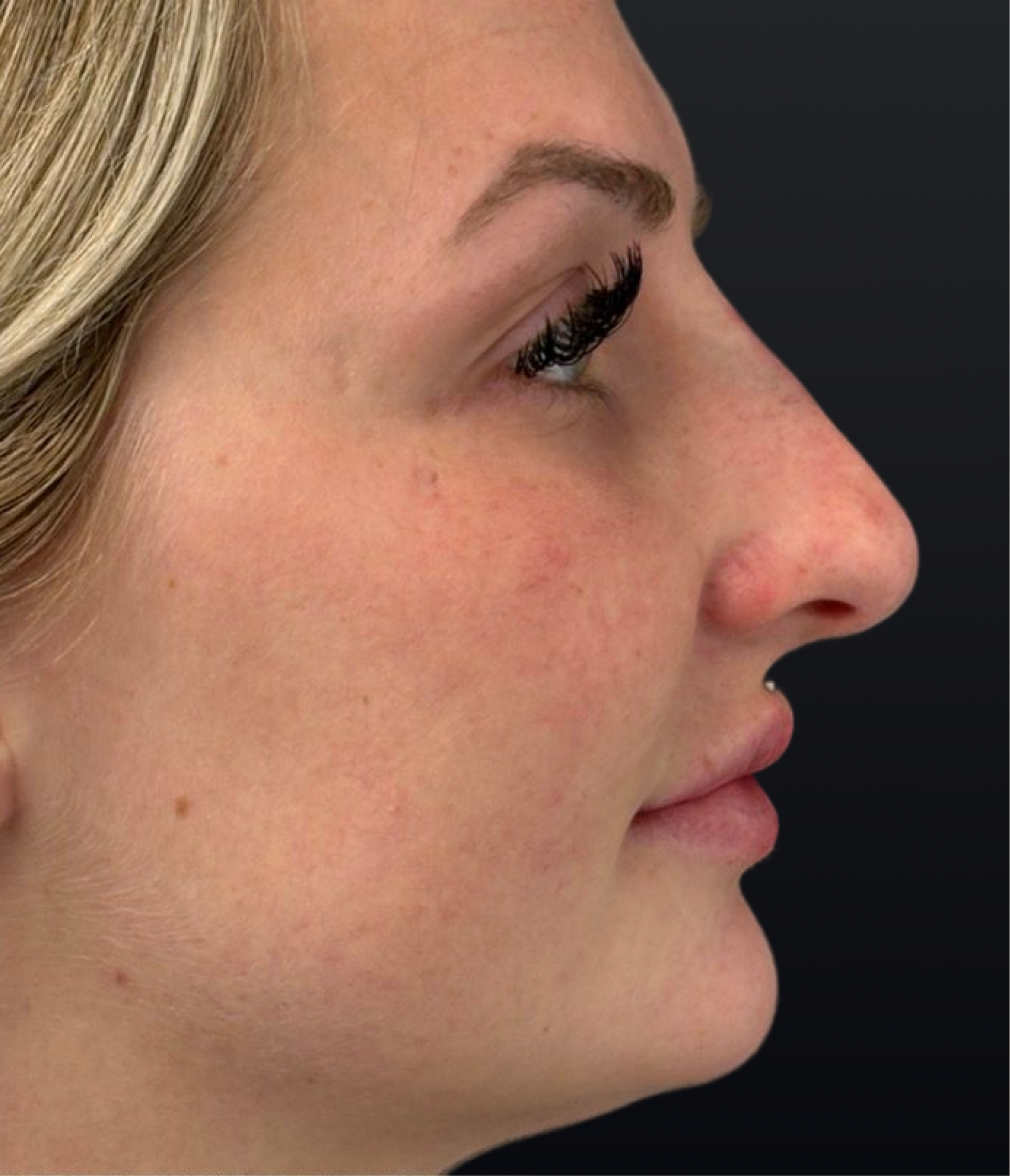 Patient #210 Before Image