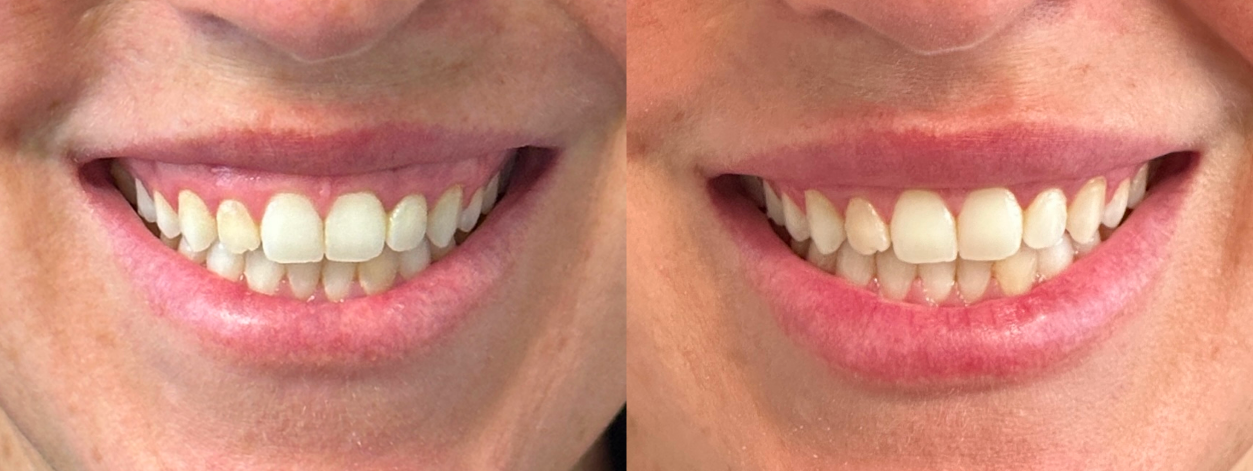 Patient #214 Marge Image