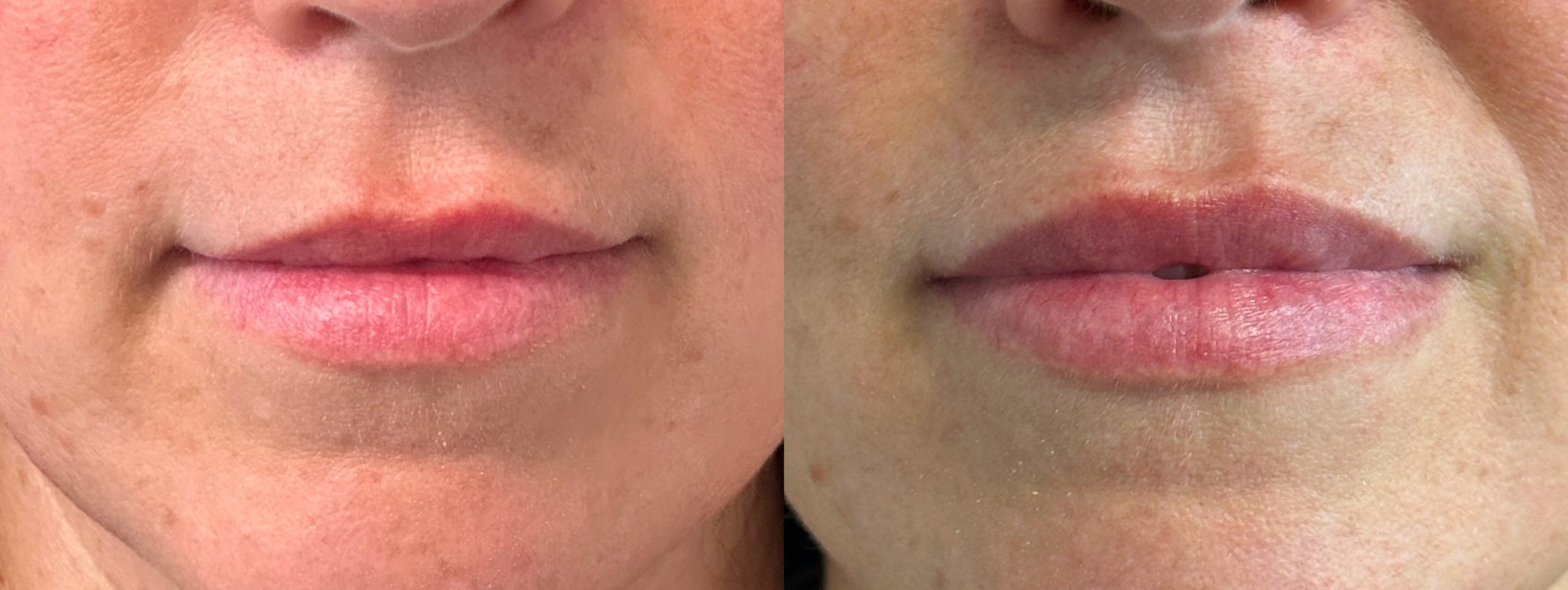 Patient #214 Marge Image