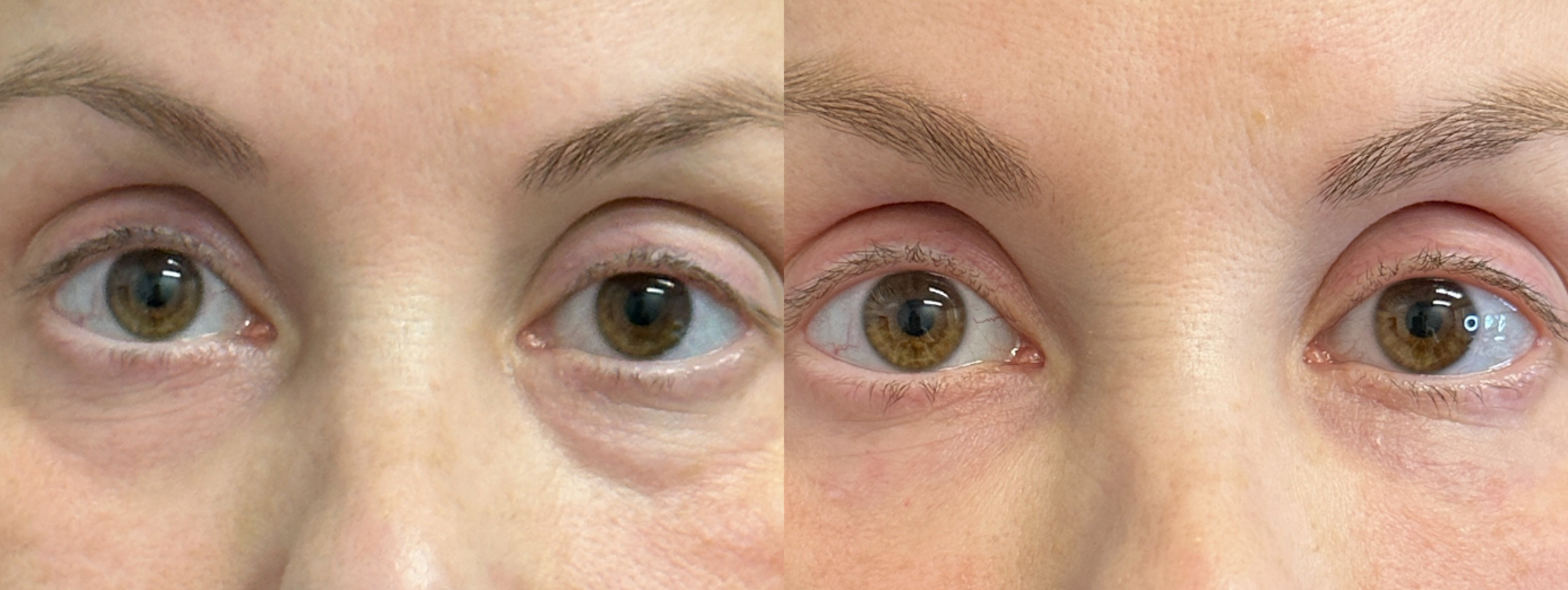 Patient #206 Marge Image