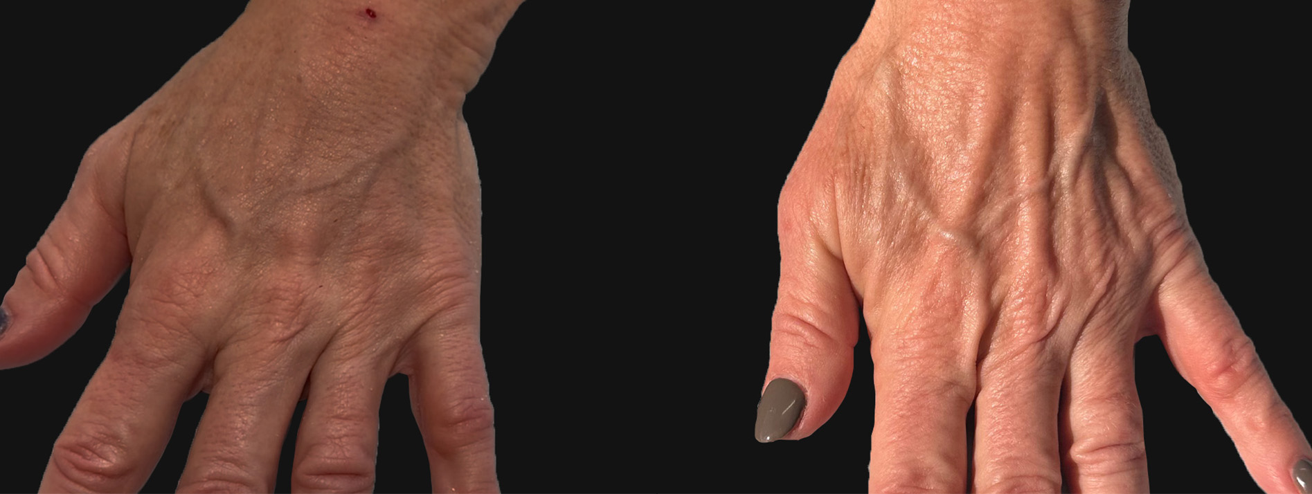 Patient #203 Marge Image