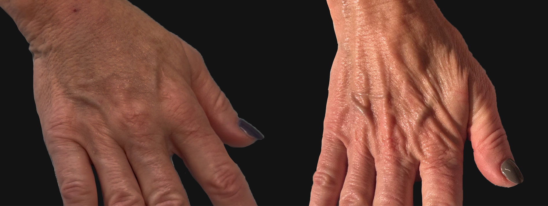 Patient #203 Marge Image