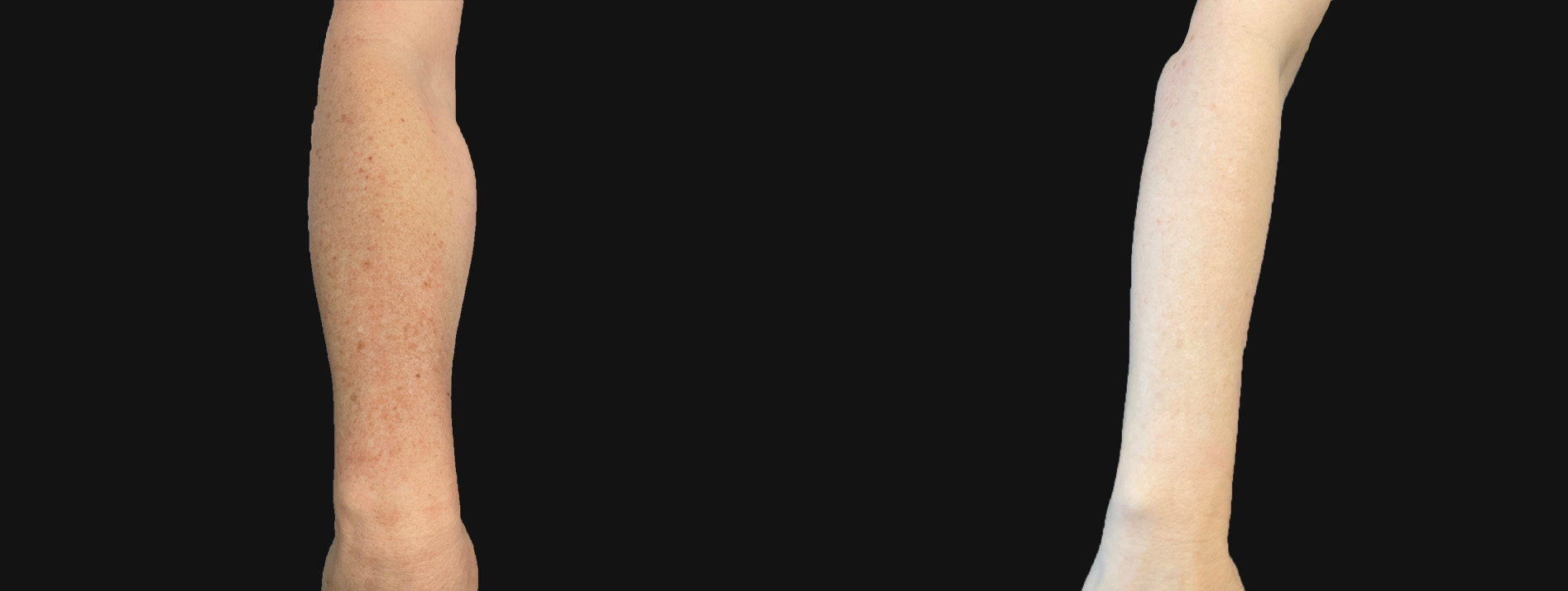 Patient #200 Marge Image