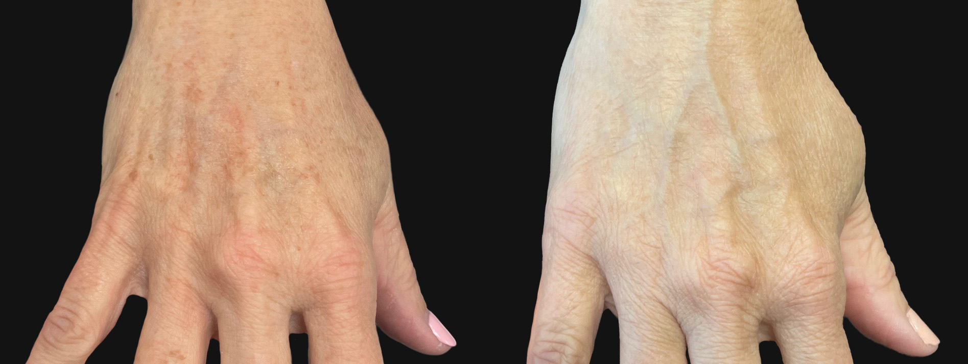 Patient #200 Marge Image