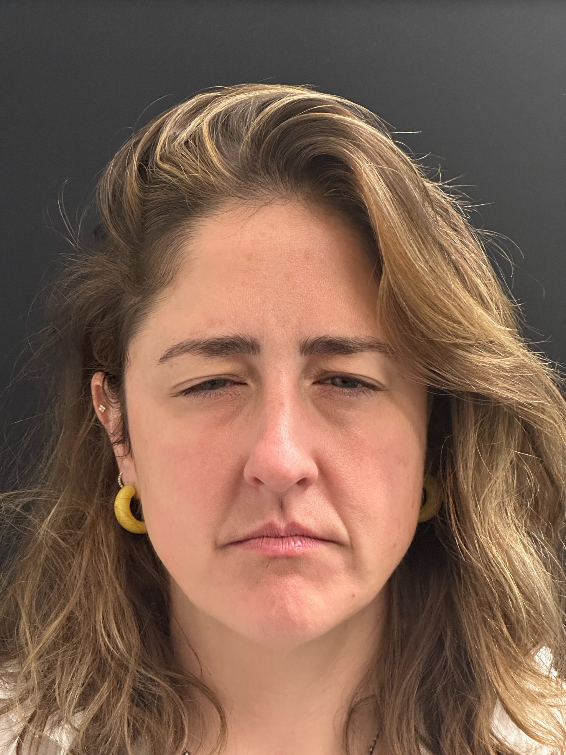 Patient #216 After Image