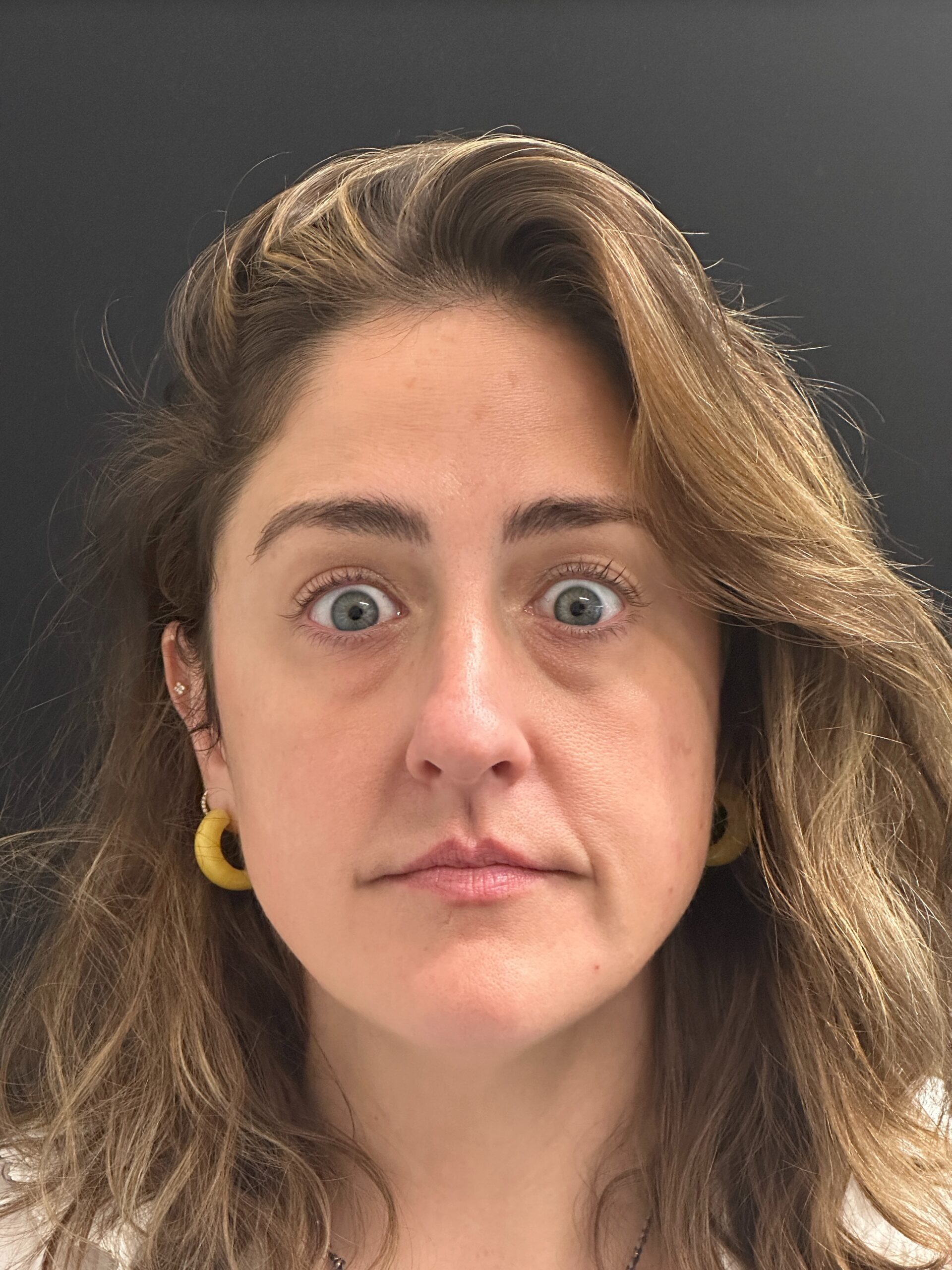 Patient #216 After Image