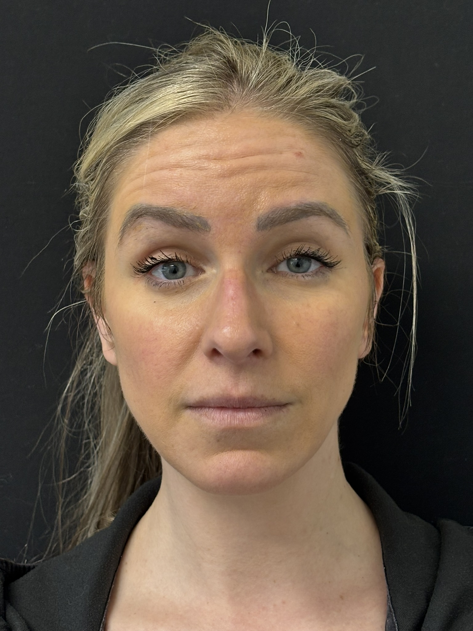 Patient #215 Before Image