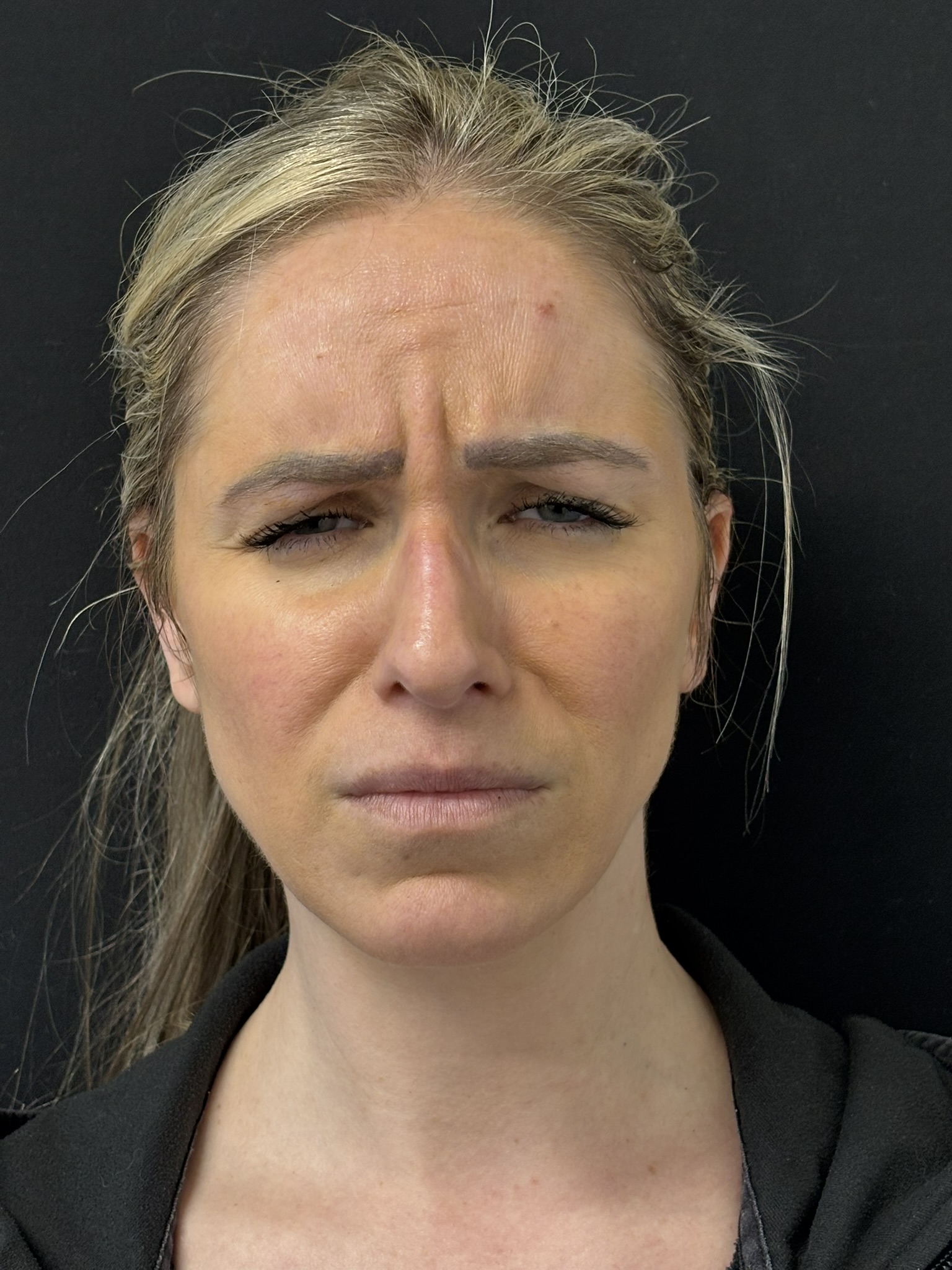 Patient #215 Before Image