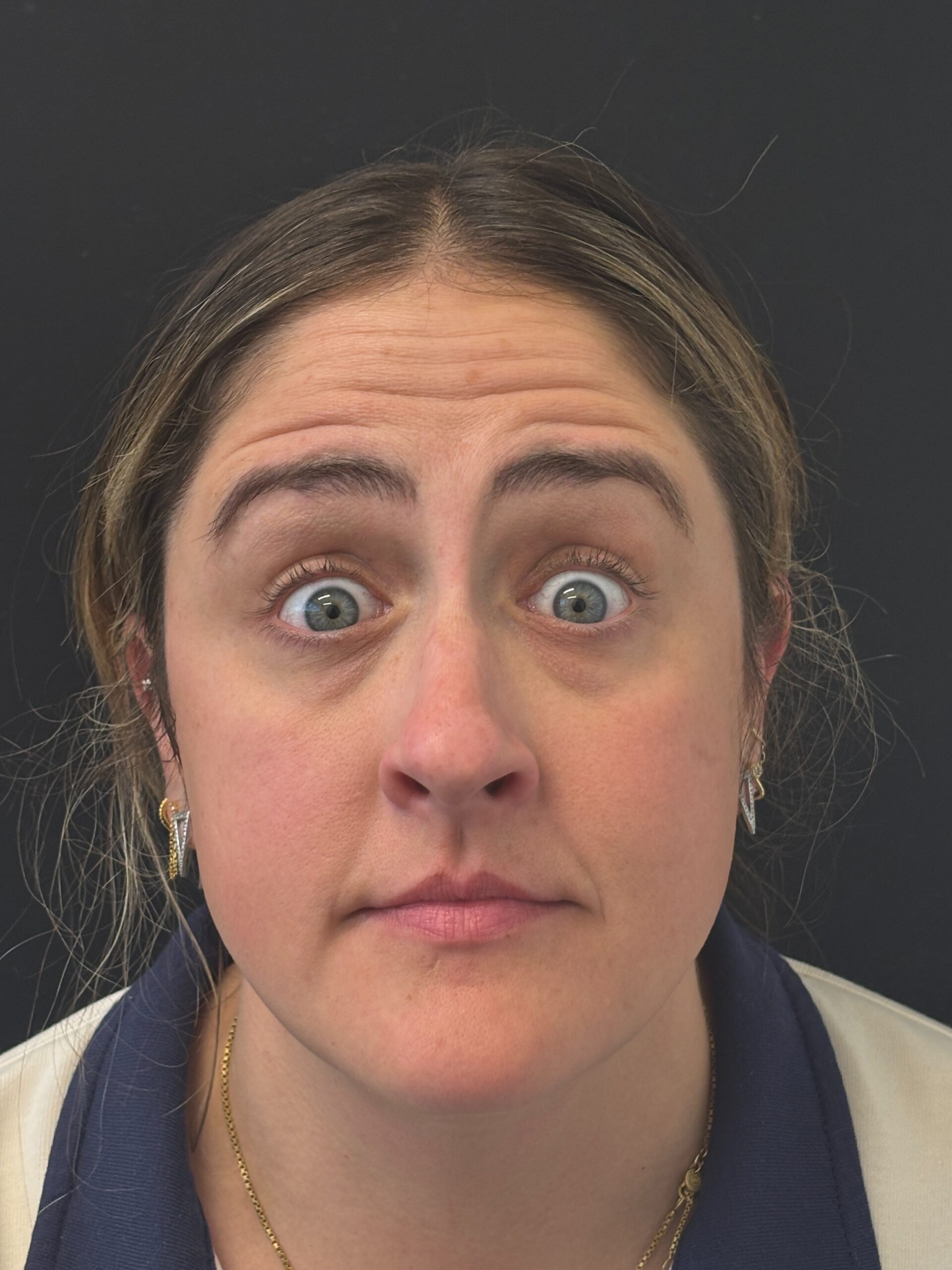 Patient #216 Before Image