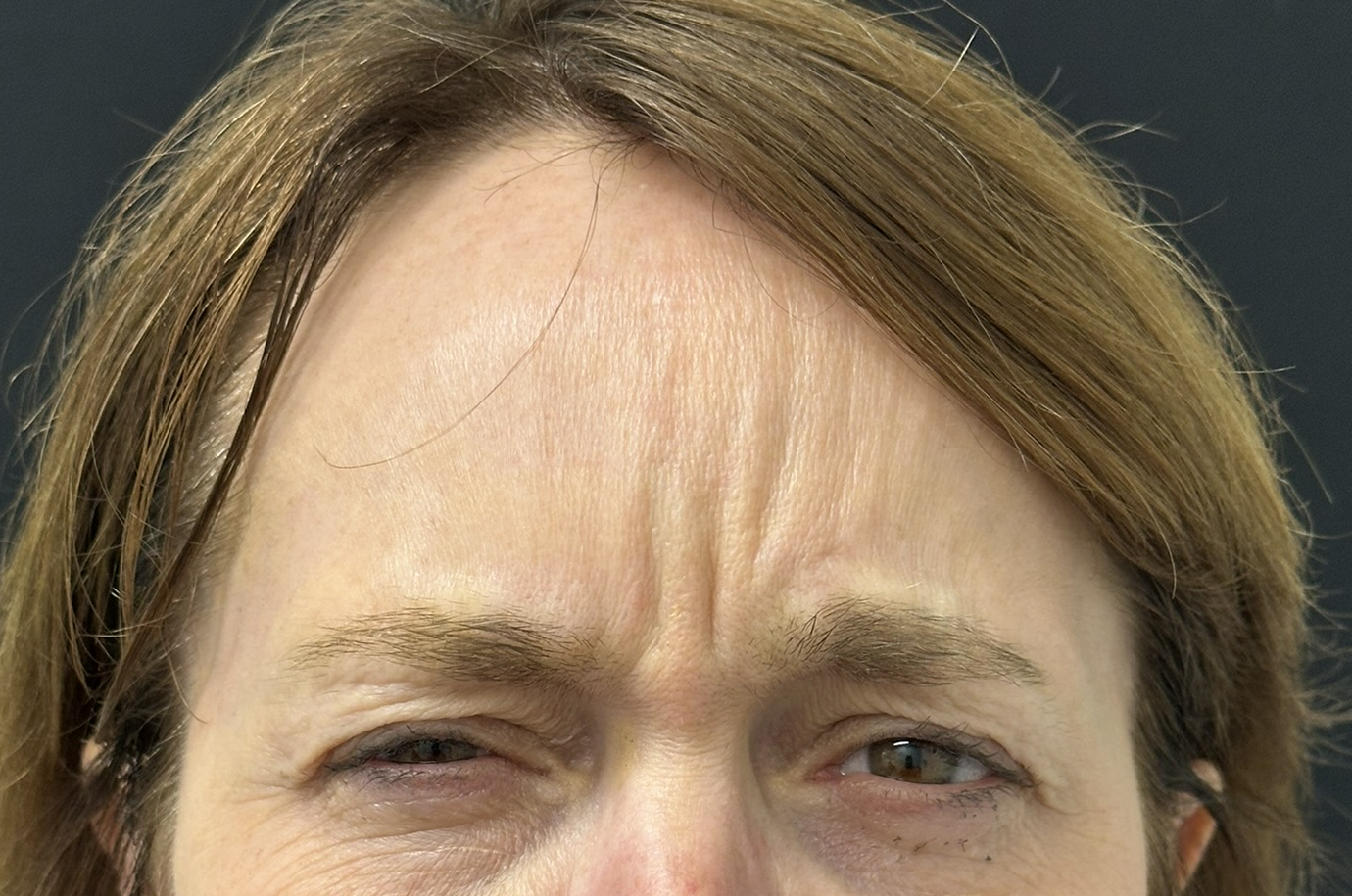 Patient #217 Before Image