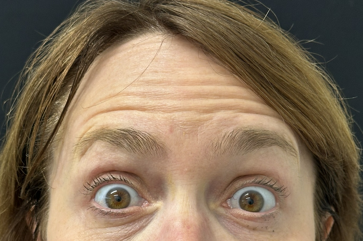 Patient #217 Before Image