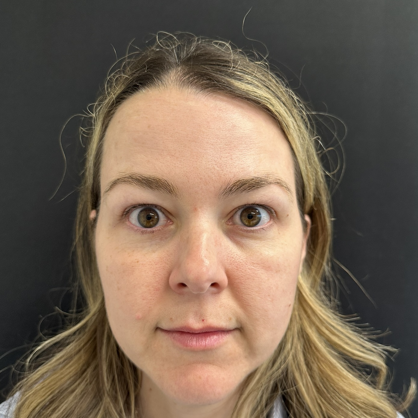 Patient #218 After Image