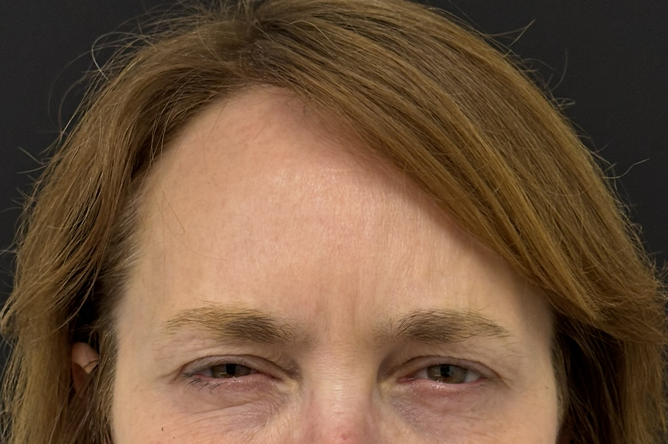 Patient #217 After Image