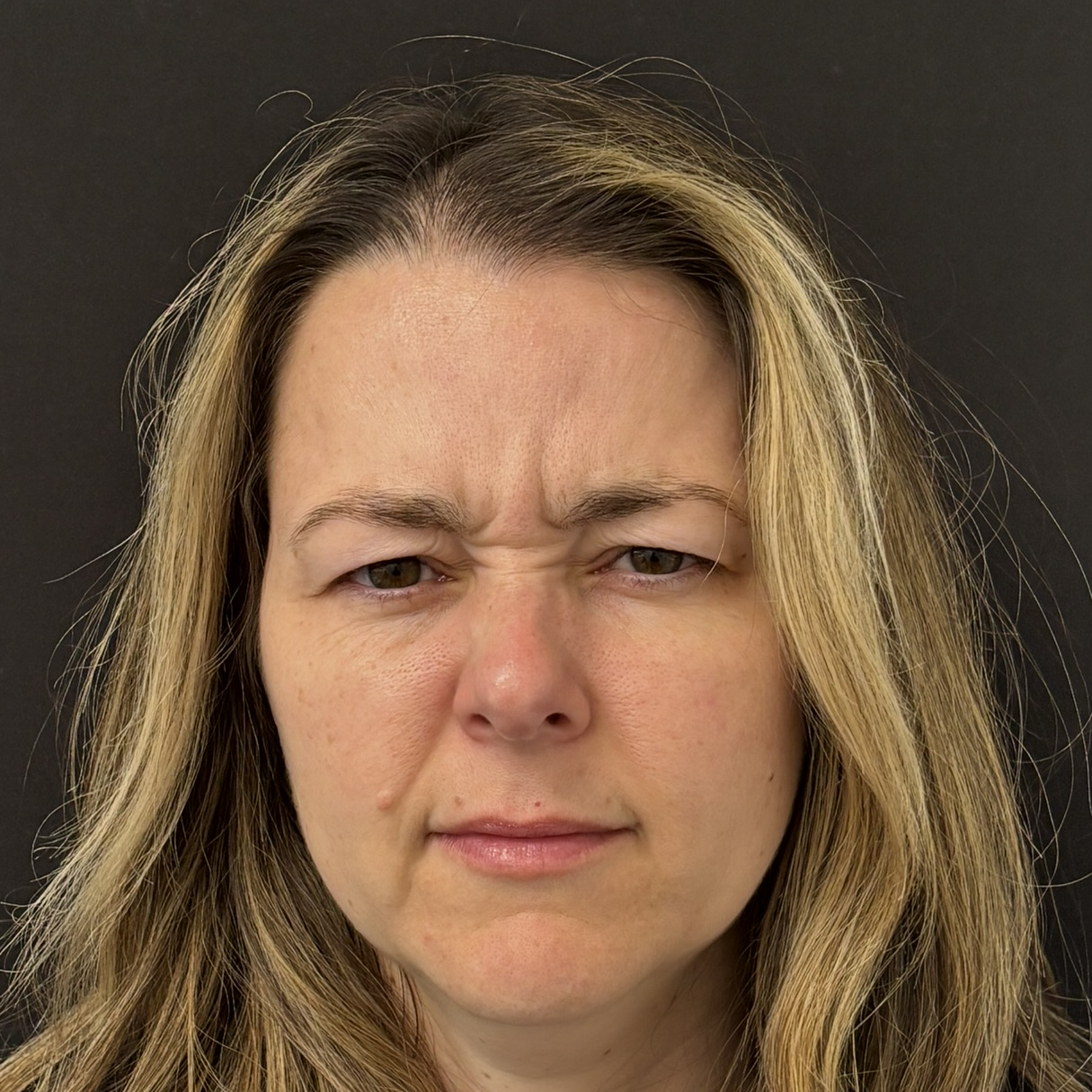 Patient #218 Before Image