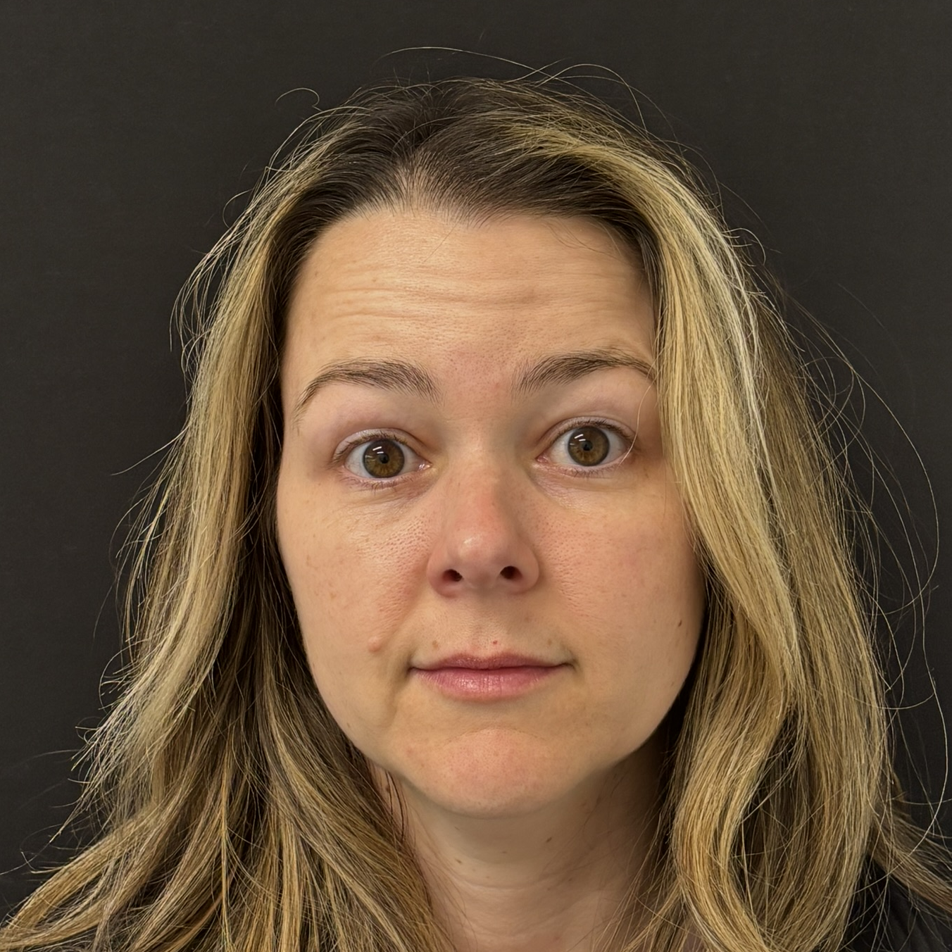 Patient #218 Before Image