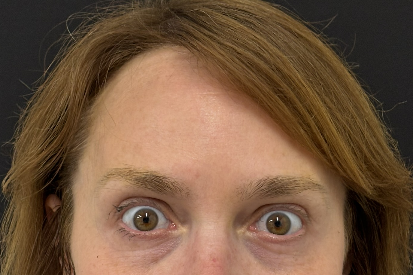 Patient #217 After Image