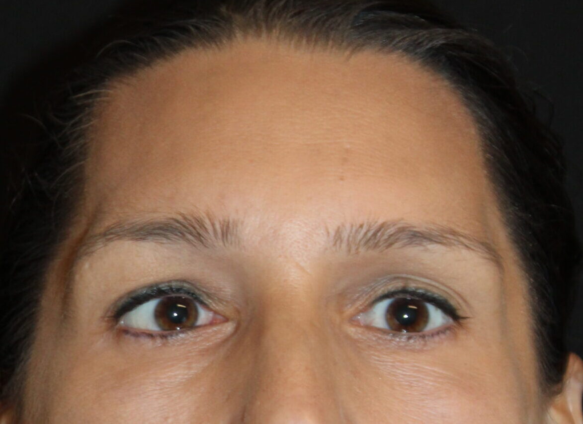 Patient #224 After Image