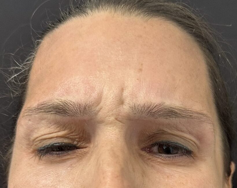 Patient #224 Before Image