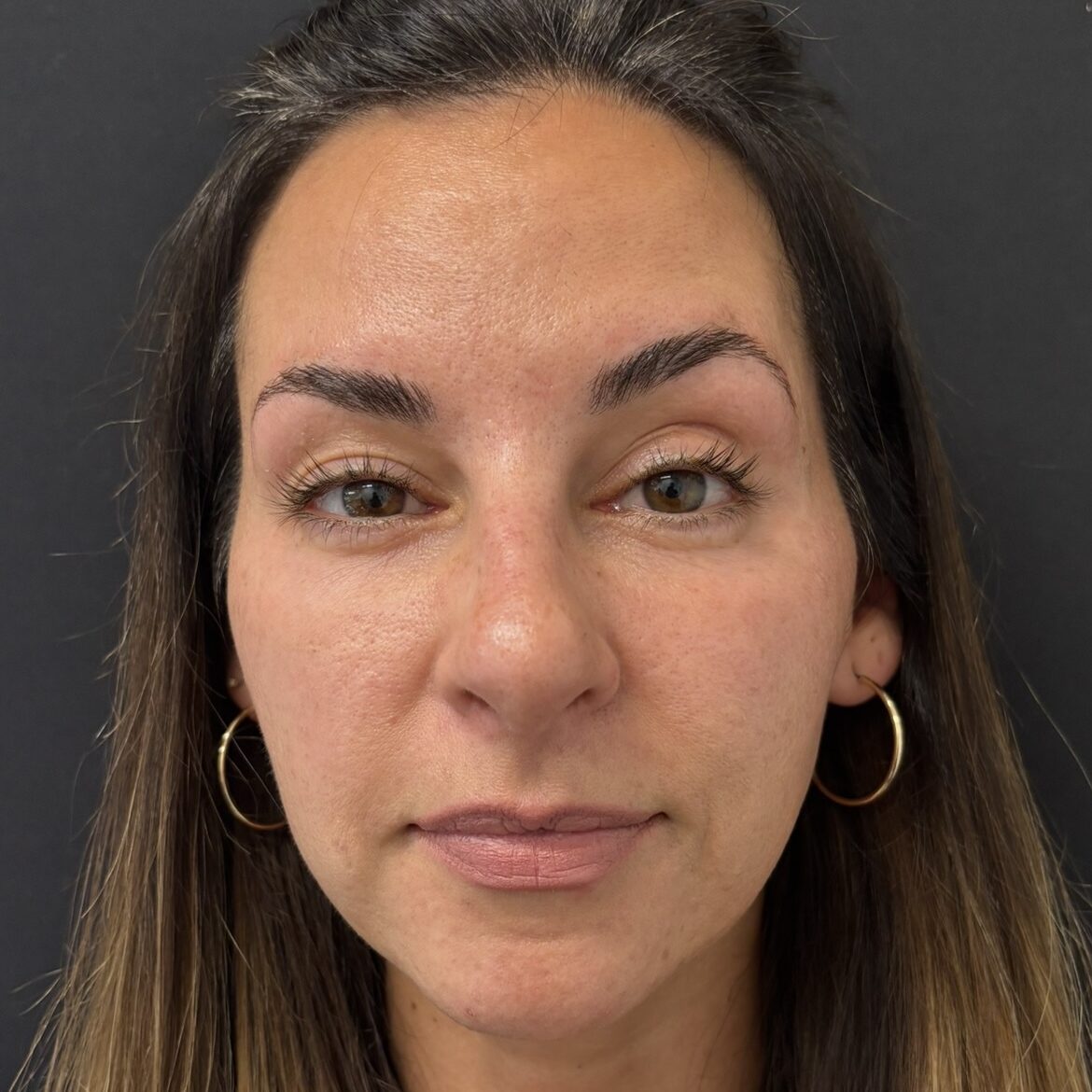 Patient #225 After Image