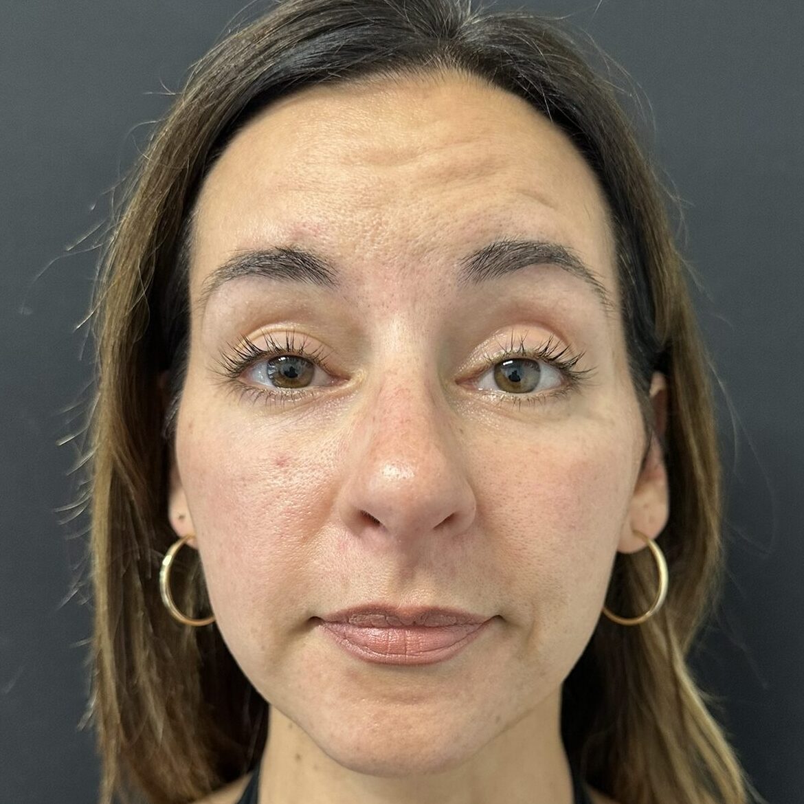 Patient #225 Before Image