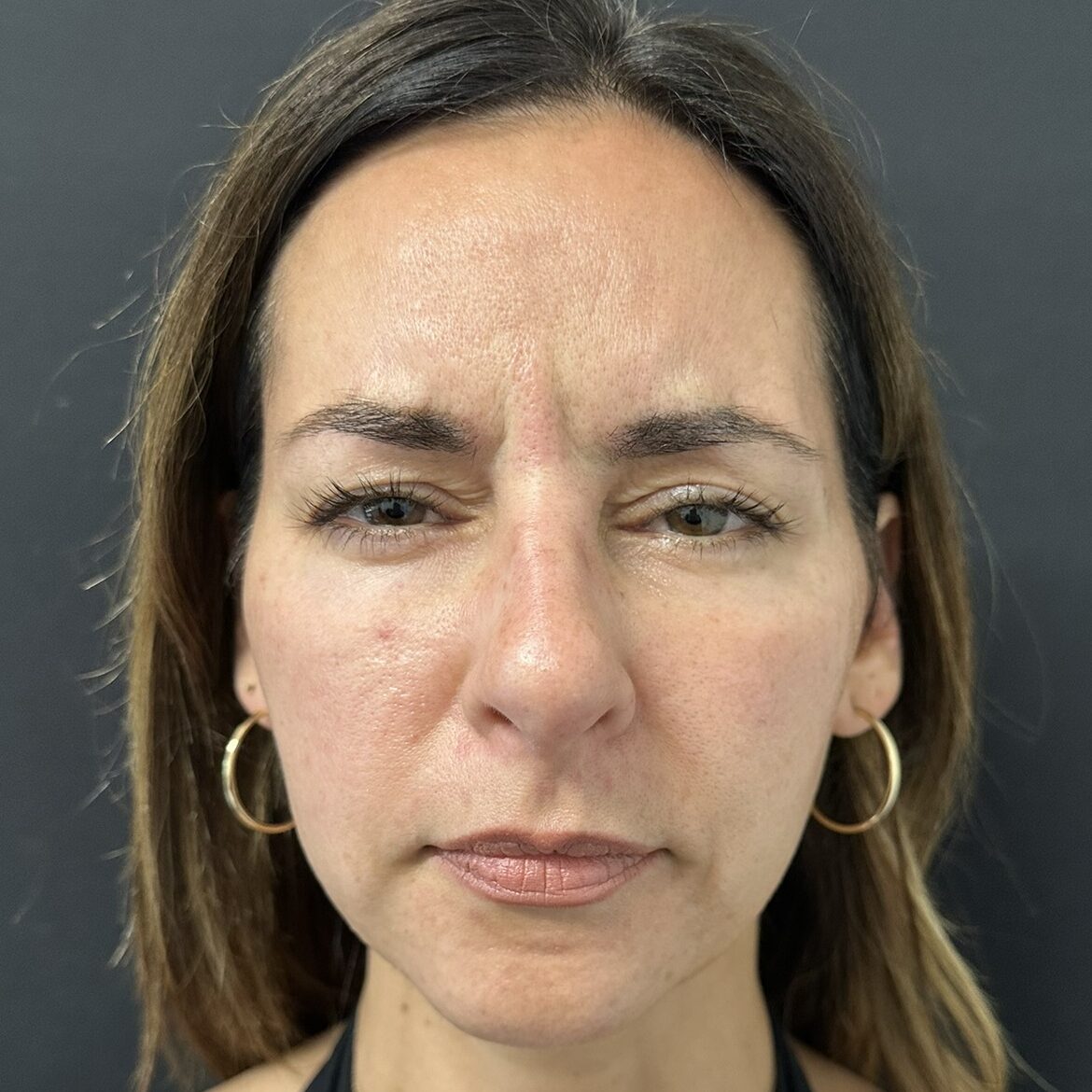 Patient #225 Before Image