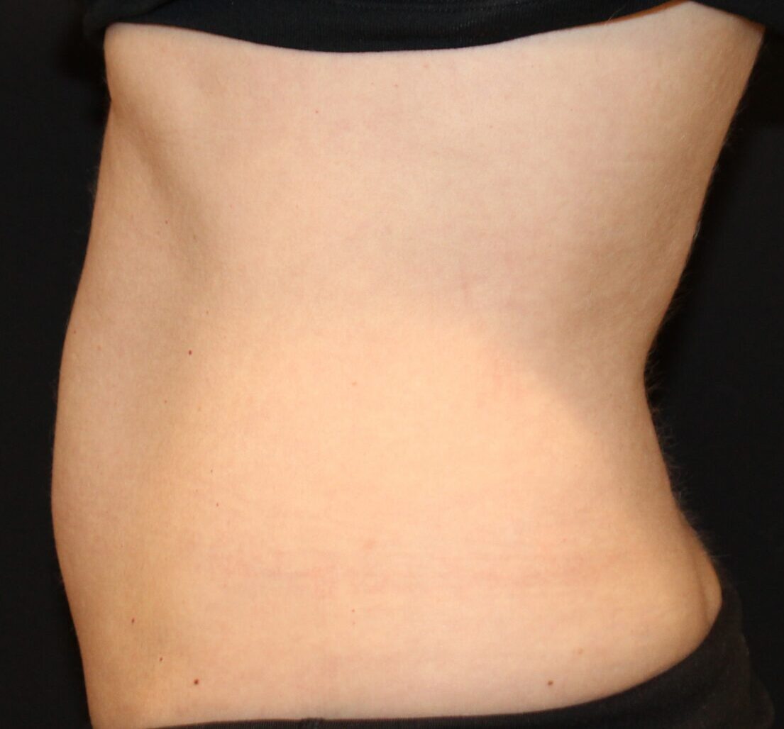 Patient #226 After Image