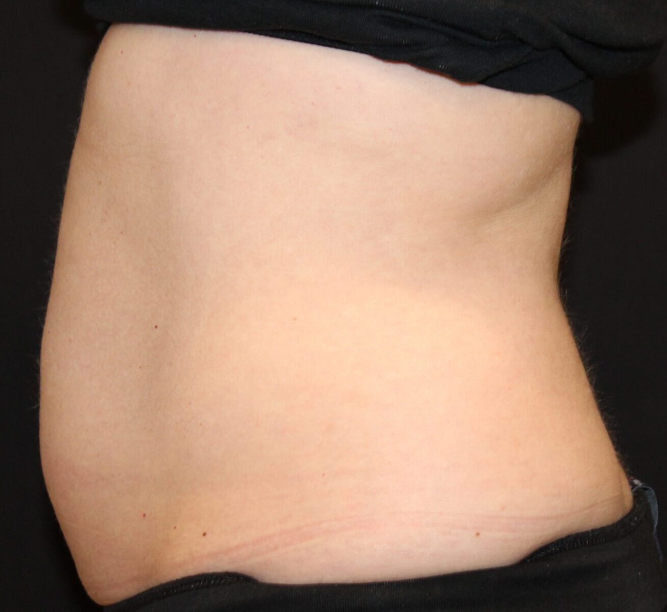 Patient #226 Before Image