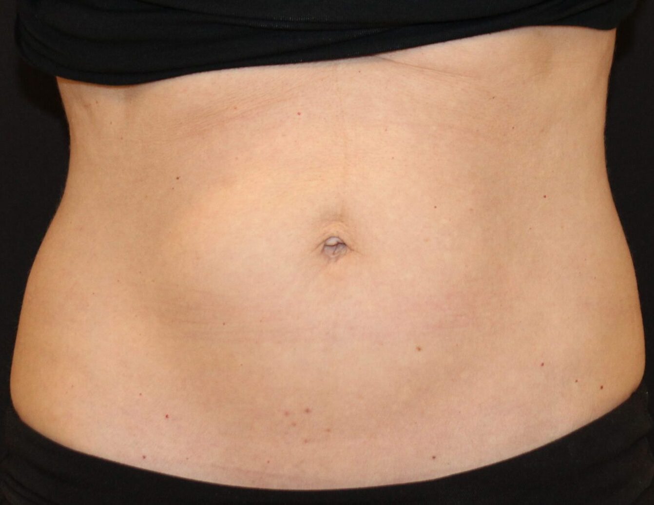 Patient #226 After Image
