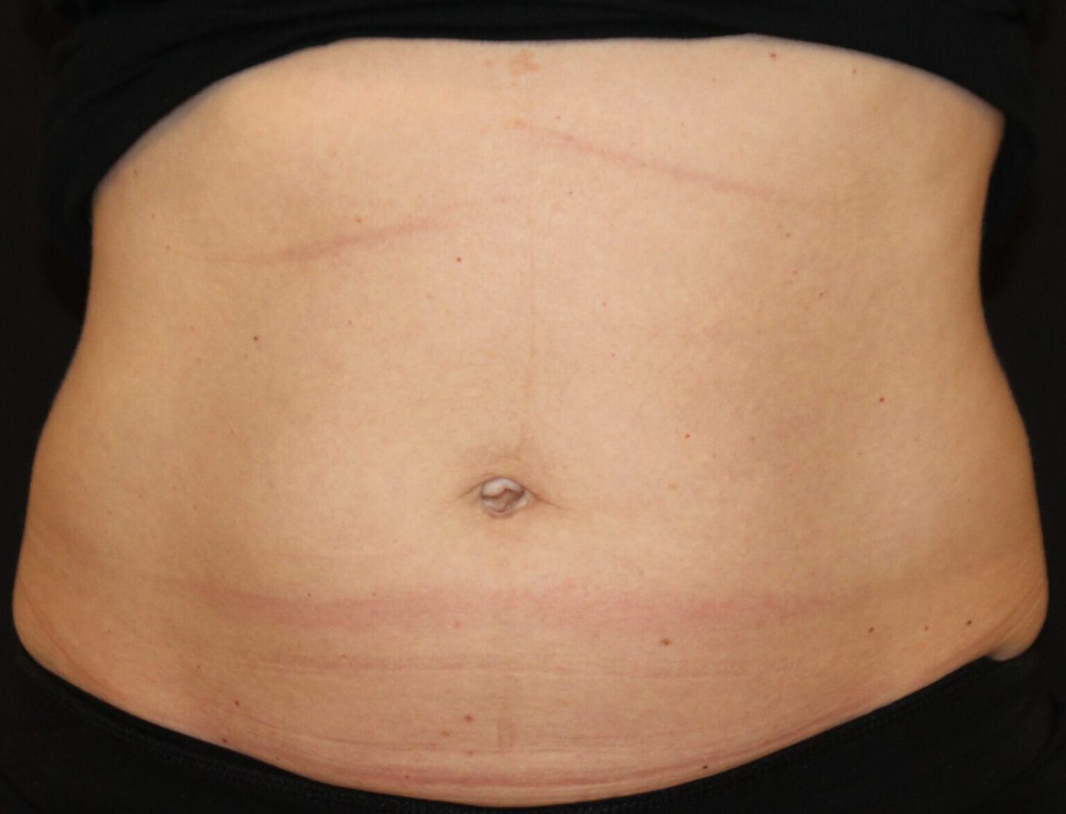 Patient #226 Before Image