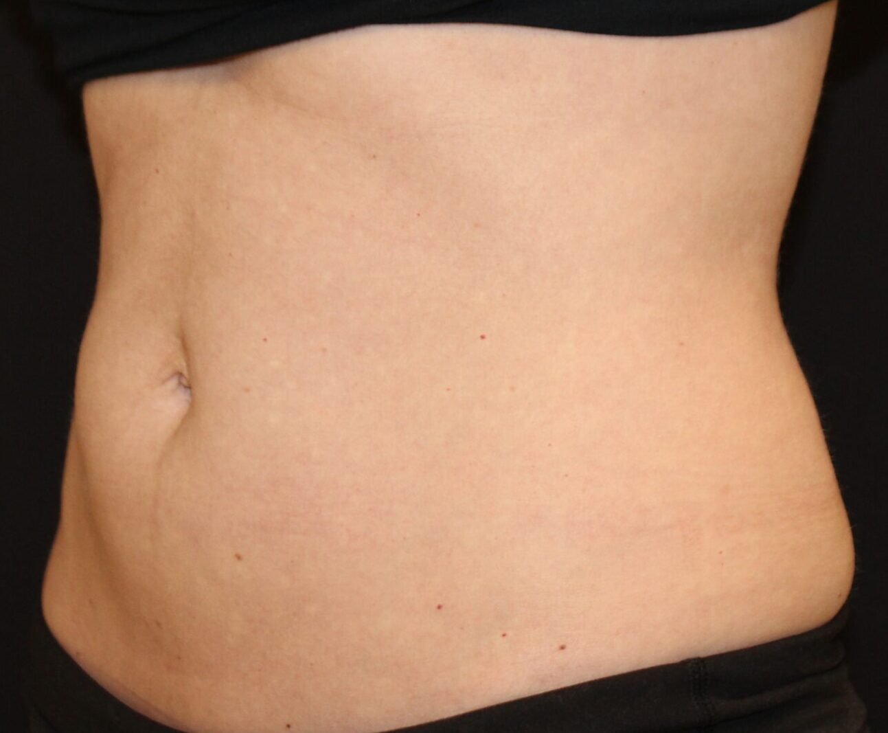 Patient #226 After Image