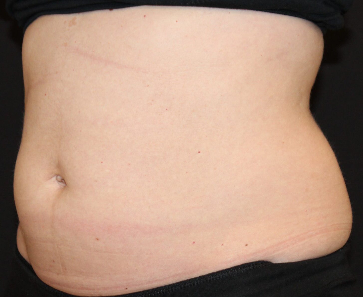 Patient #226 Before Image