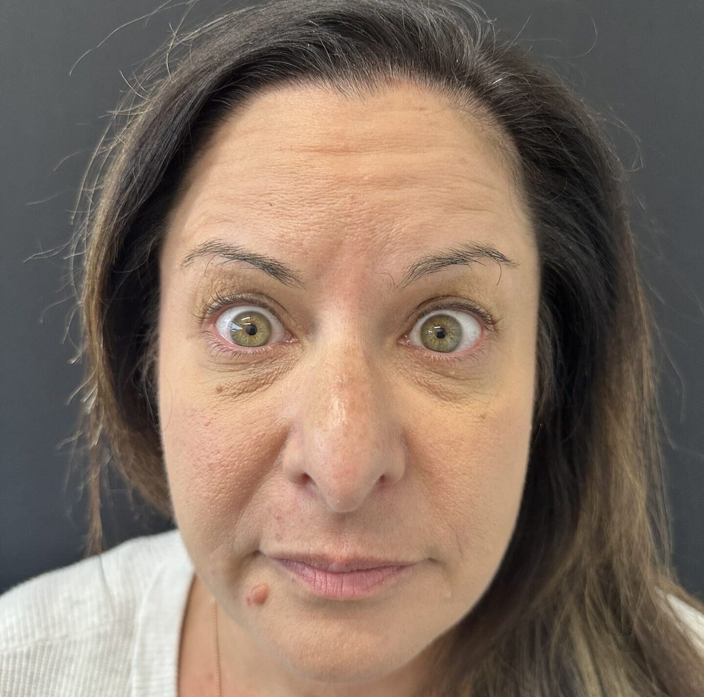 Patient #231 Before Image