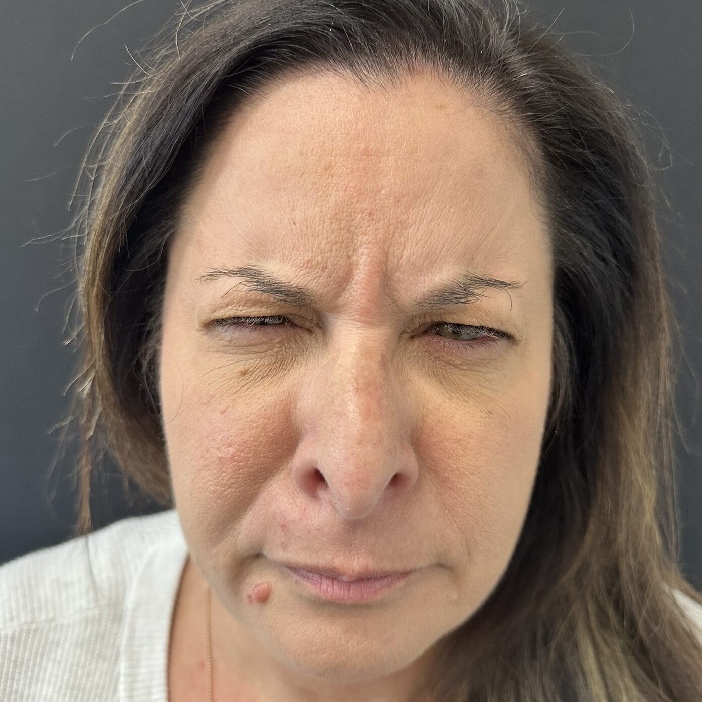 Patient #231 Before Image