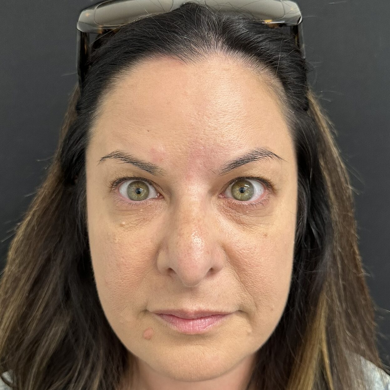 Patient #231 After Image
