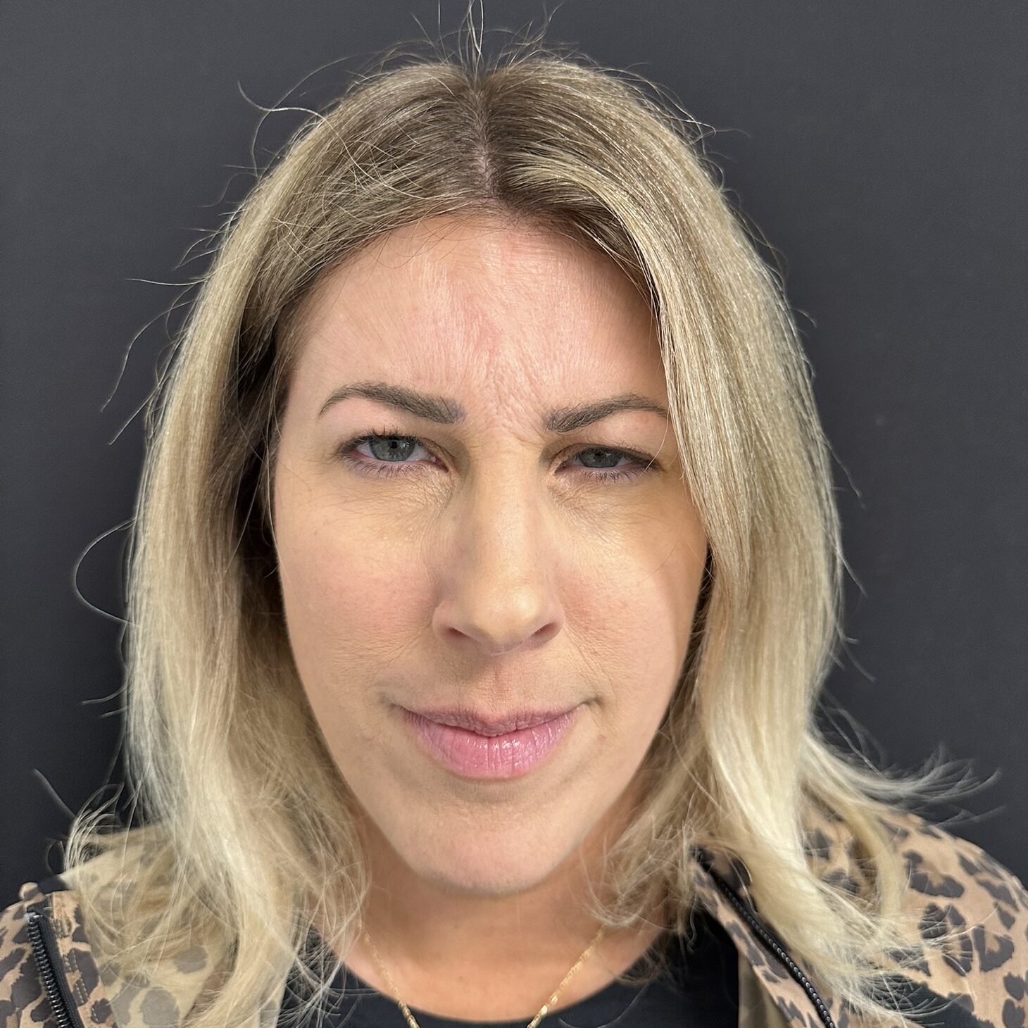 Patient #235 Before Image