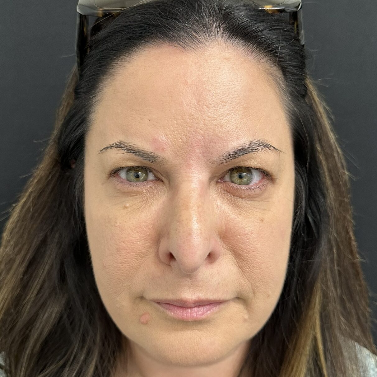 Patient #231 After Image