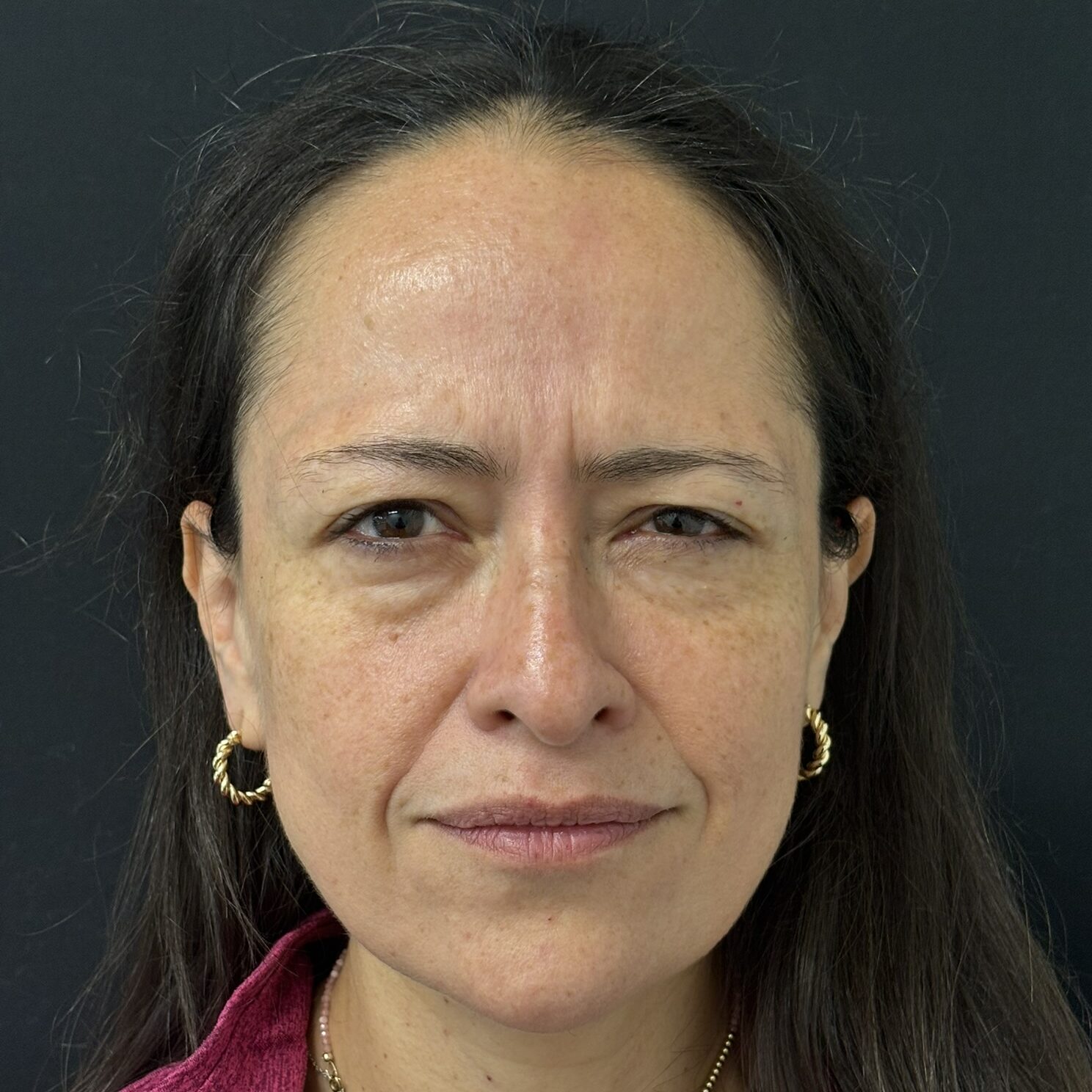 Patient #237 Before Image