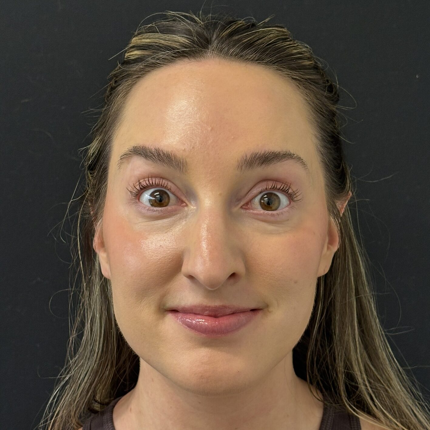 Patient #236 After Image