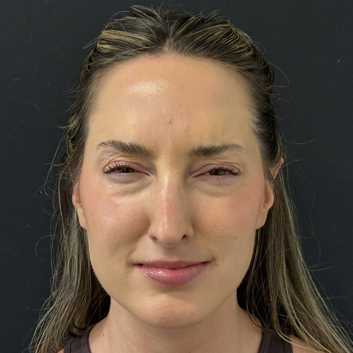 Patient #236 After Image