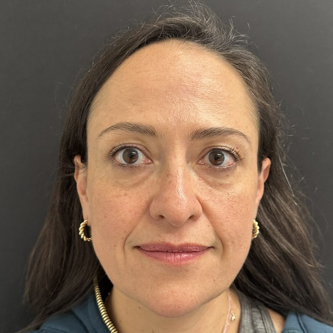 Patient #237 After Image
