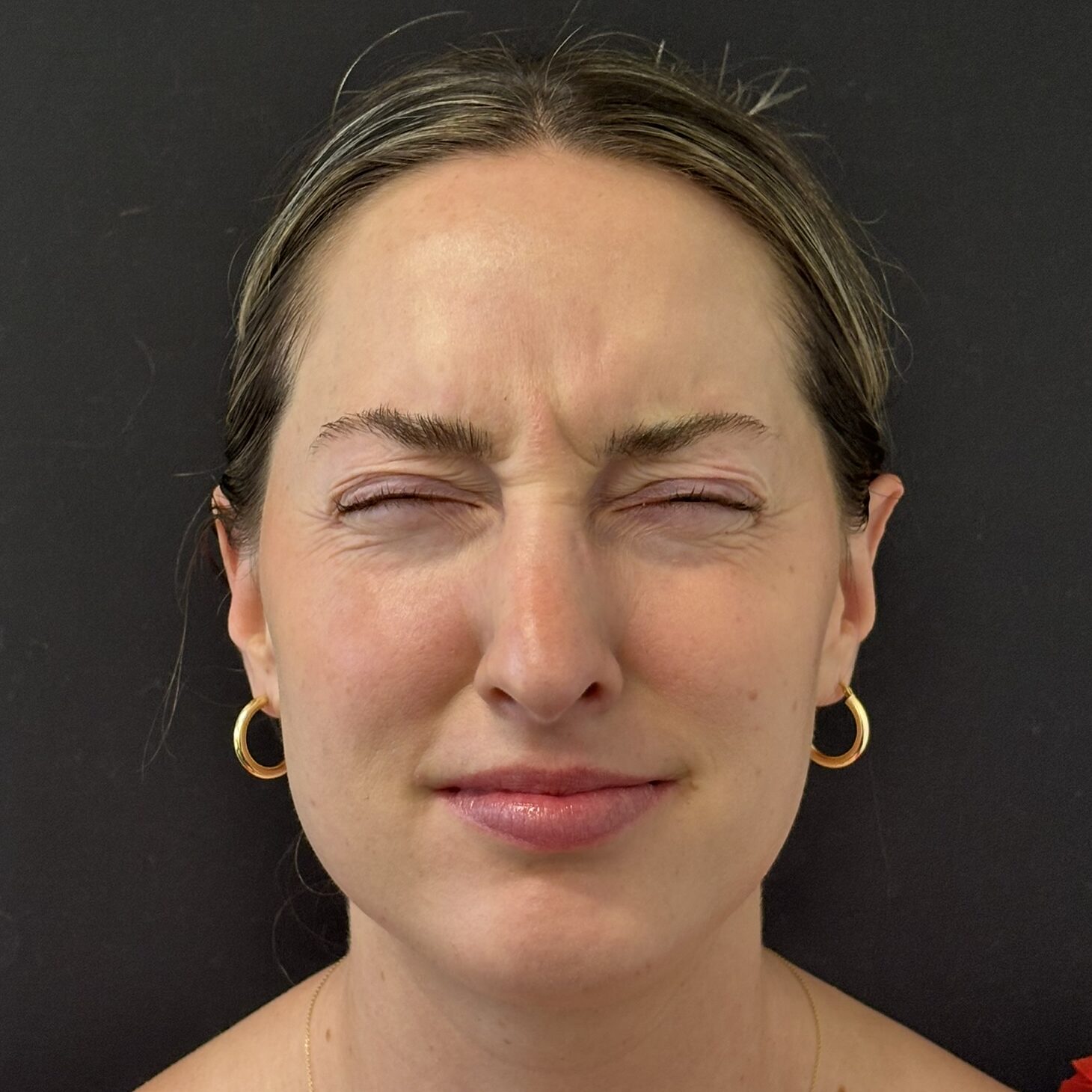 Patient #236 Before Image