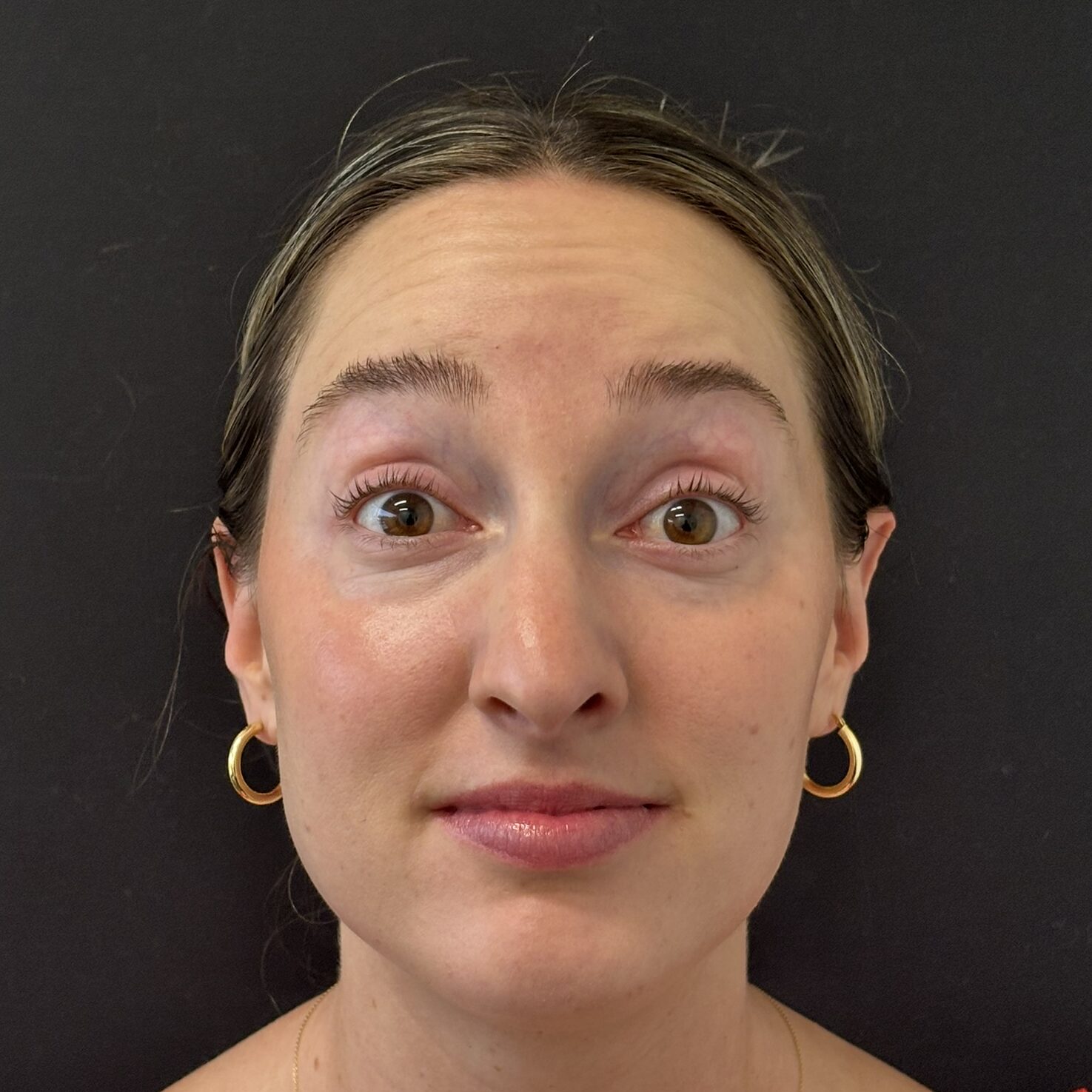 Patient #236 Before Image